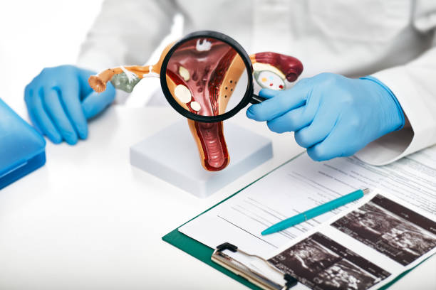 Человек в перчатках держит увеличительное стекло над моделью женской репродуктивной системы с медицинскими документами и ультразвуковыми изображениями.