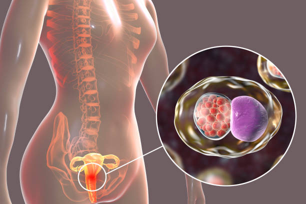 Иллюстрация женской репродуктивной системы с изображением бактериальной инфекции Chlamydia trachomatis крупным планом.